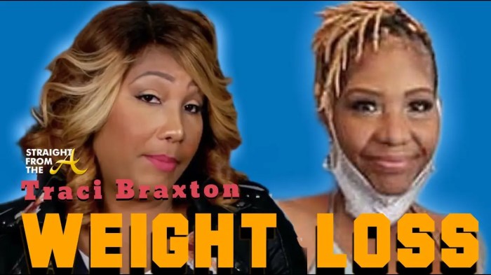 Traci braxton weight loss surgery